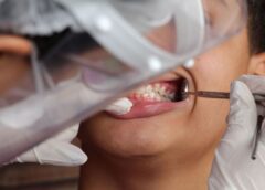 Planos odontológicos registraram 32,2 milhões de usuários em outubro